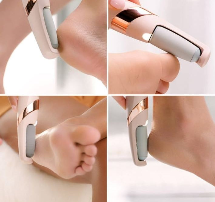 Rechargeable Electric Foot Filer – Callus Remover for Smooth & Soft Feet